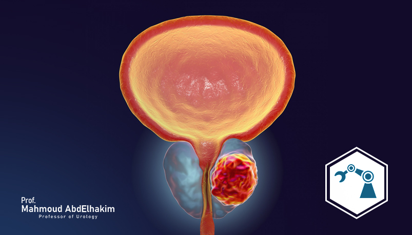 Robotic-assisted prostatectomy