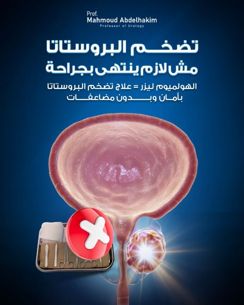 مميزات العلاج مع د. محمود عبد الحكيم أفضل دكتور بروستاتا بالليزر