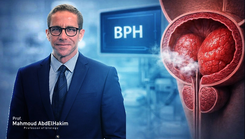 افضل دكتور لعلاج تضخم البروستاتا الحميد BPH